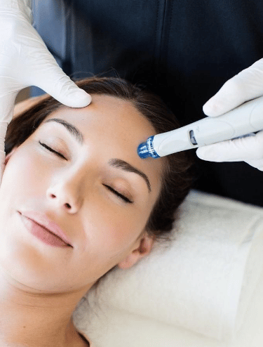 Hydra Facial - Image 2