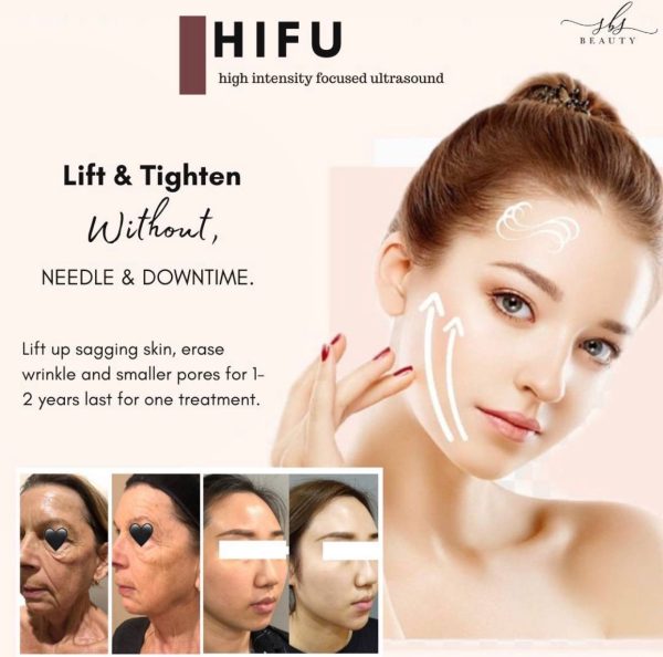Hifu Ultheraphy Hifu