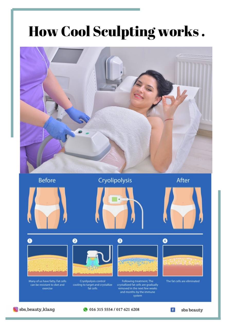 Coolsculpting Fat Freezing