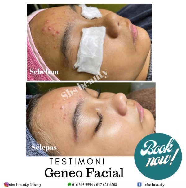 Geneo Super Facial - Image 4