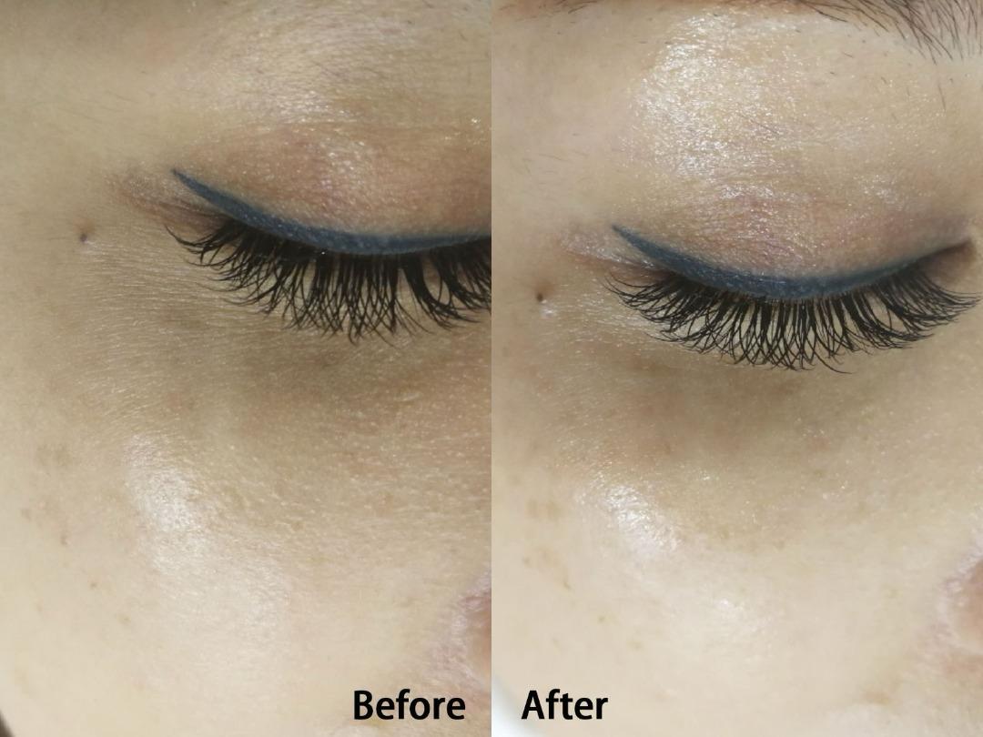 Rawatan Kiss Eye - Image 3